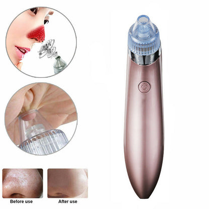 Acne Pimple Remover Strong Suction Tool