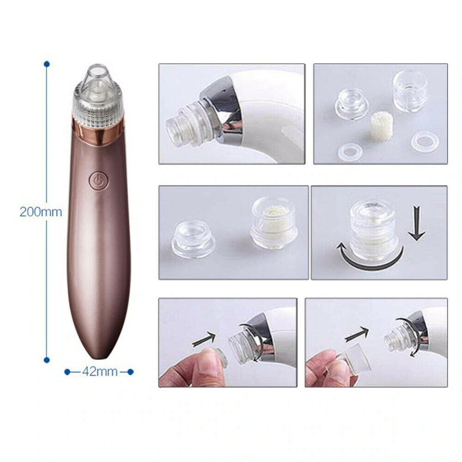 Acne Pimple Remover Strong Suction Tool