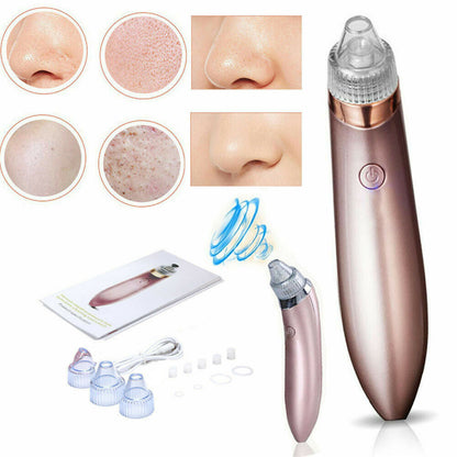 Acne Pimple Remover Strong Suction Tool